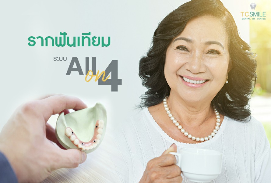 รากฟันเทียม All-On-4 ทดแทนฟันหายทั้งปาก ได้ฟันใหม่ไม่ต้องทำฟันปลอมอีกต่อไป