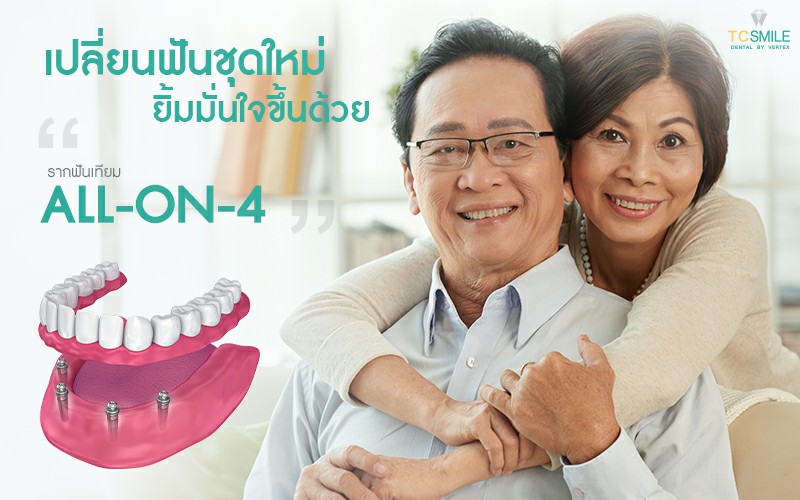 เปลี่ยนฟันใหม่ถาวร ทดแทนฟันหายทั้งปากด้วยรากฟันเทียม All-On-4