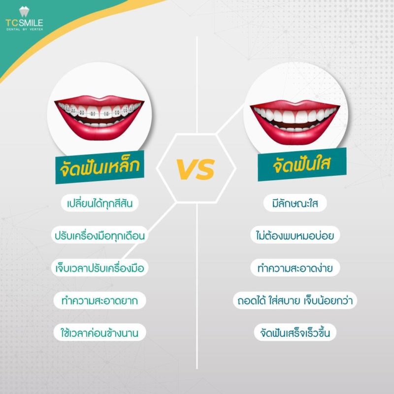 dental dental