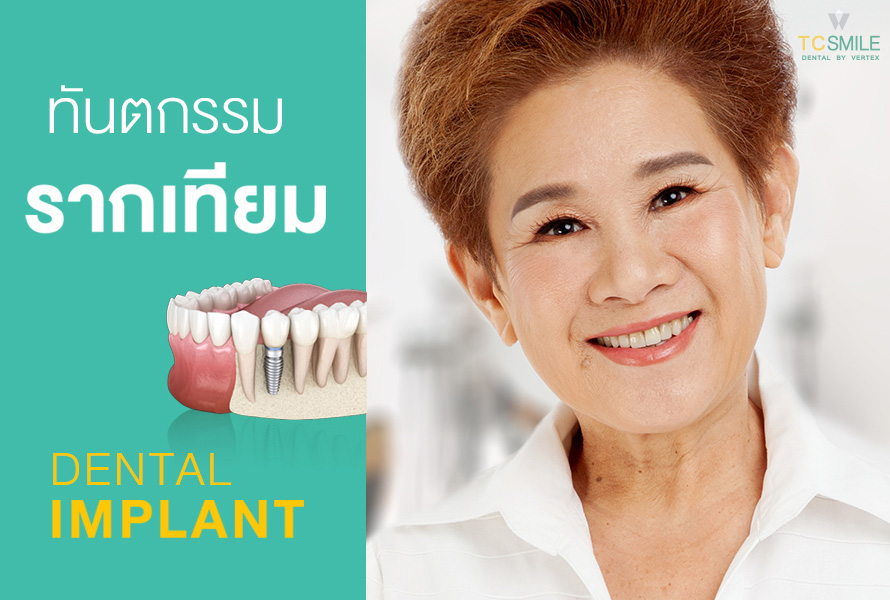 รากฟันเทียม ทันตกรรมรากเทียม ทำรากฟันเทียม