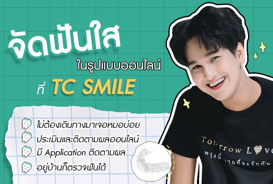 จัดฟันใสออนไลน์