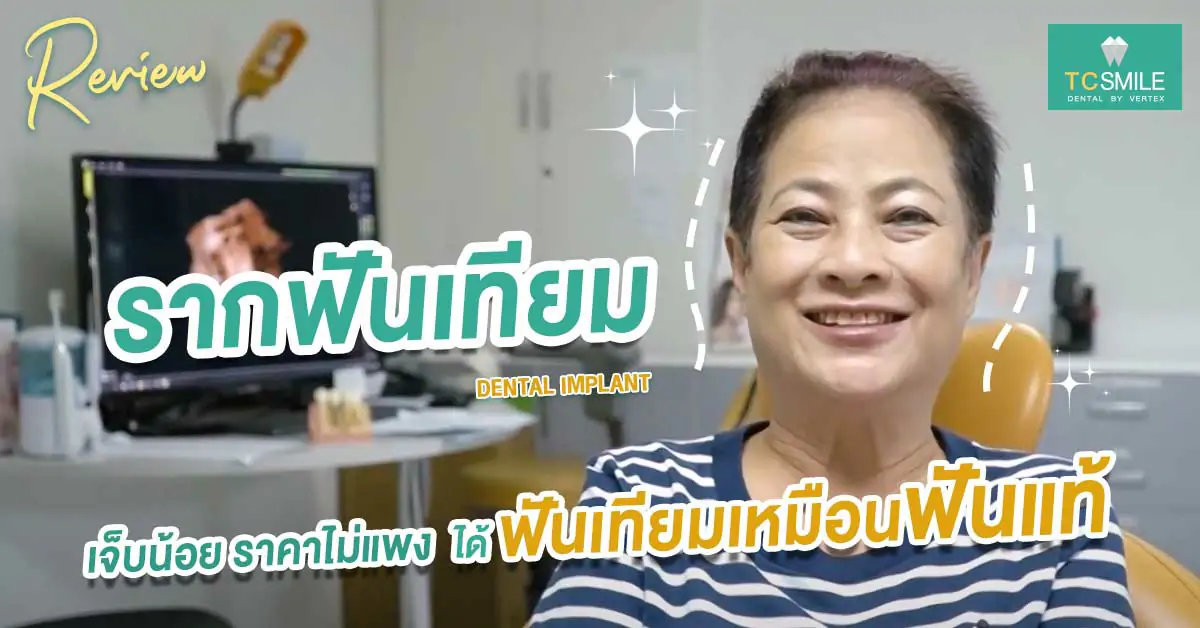 รากฟันเทียม