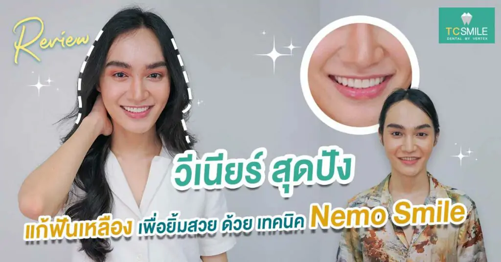 วีเนียร์