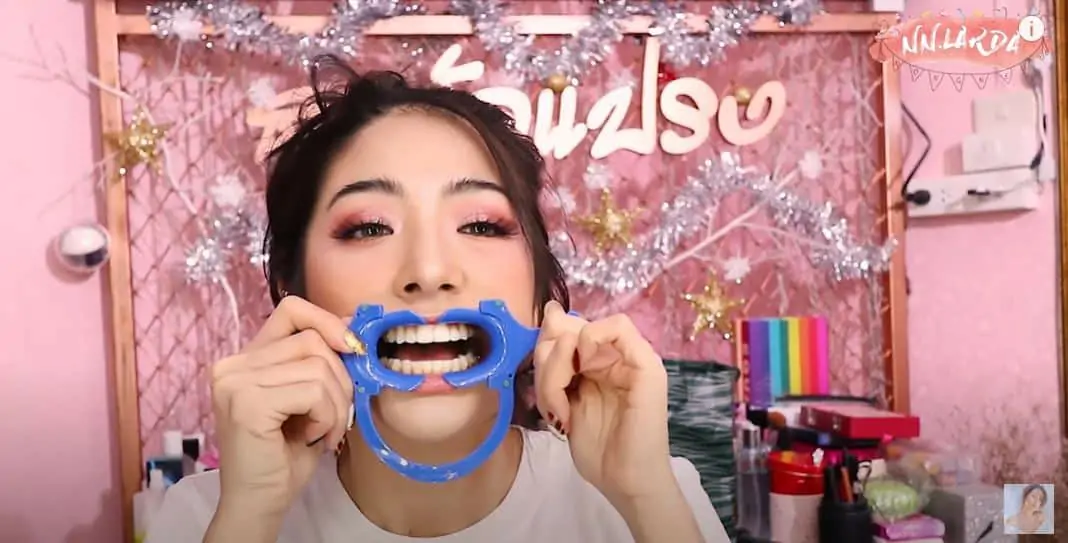 รีวิวจัดฟันแบบใส