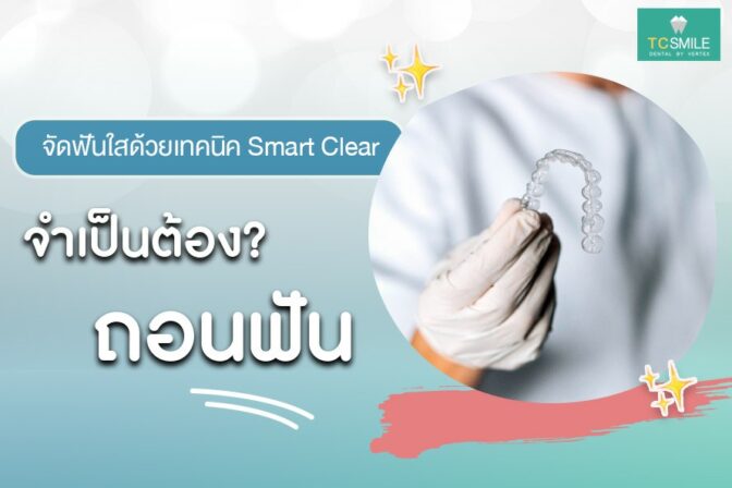 จัดฟันใสต้องถอนฟันไหม