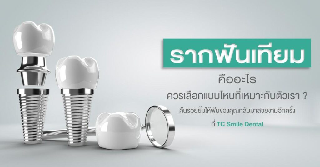 dental-implant-tooth-artificial