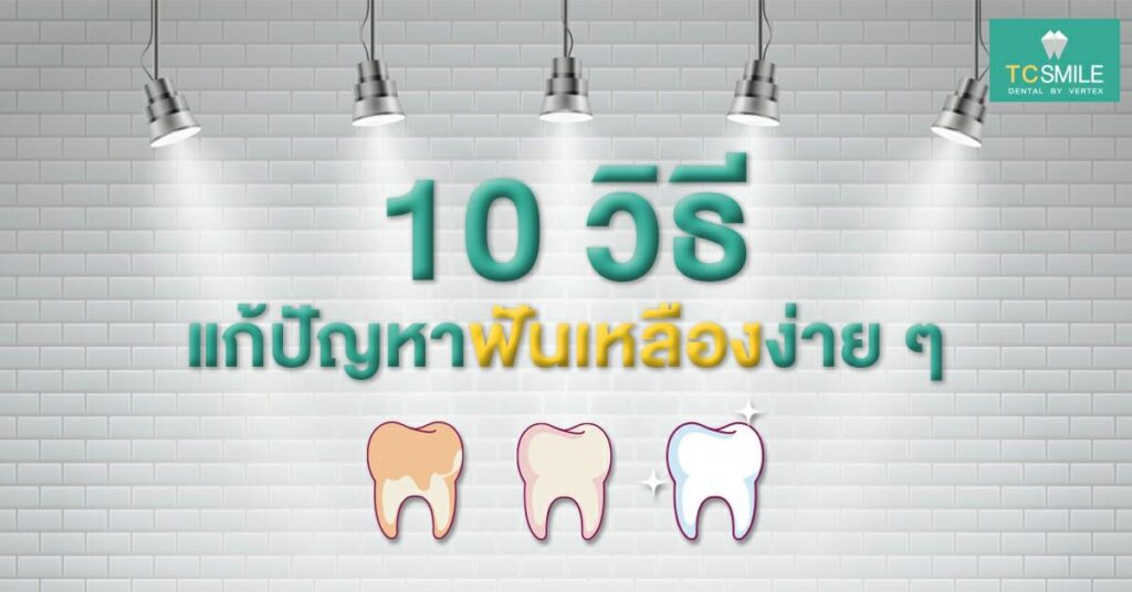 namel-white-teeth-veneer