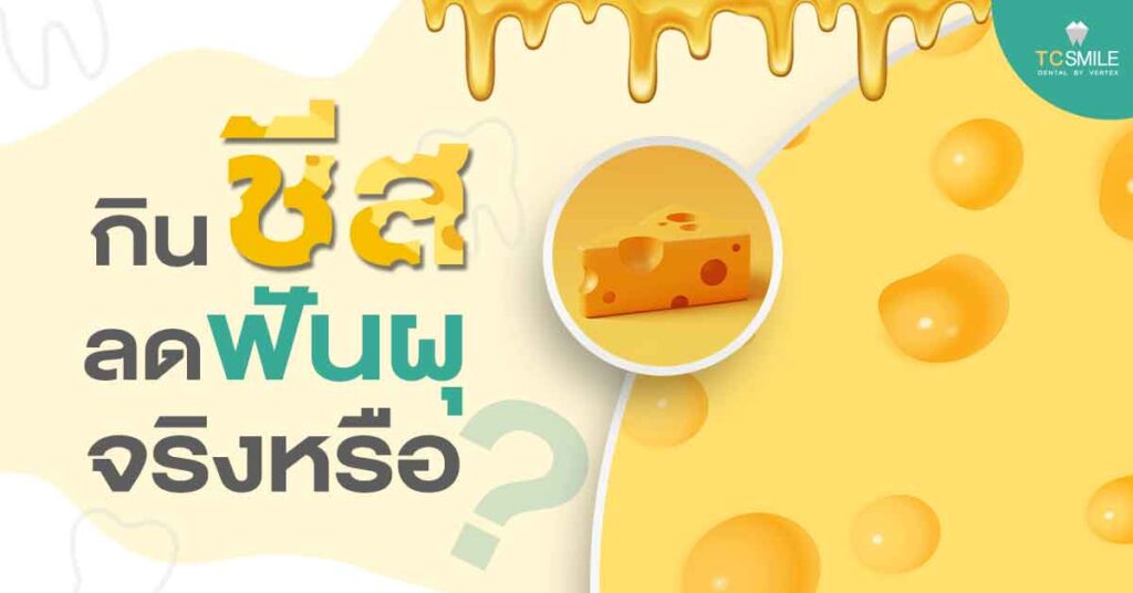 tooth-decay-cheese-prevent