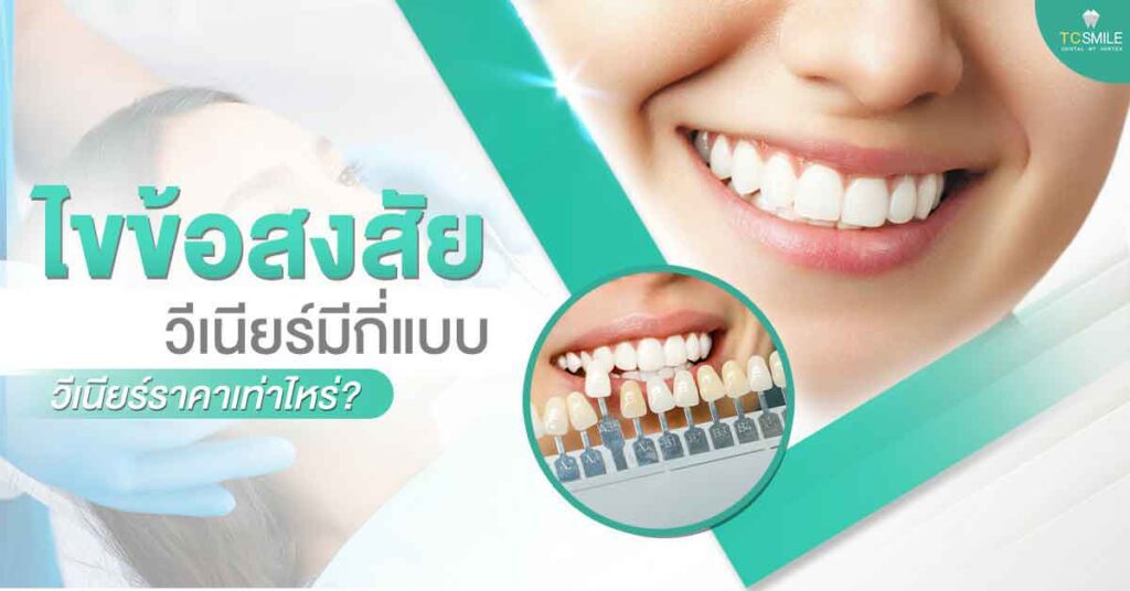 veneer-tooth-beautiful-teeth