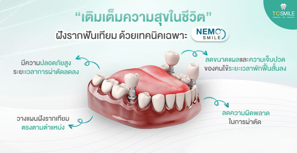 implant-false-teeth-tooth