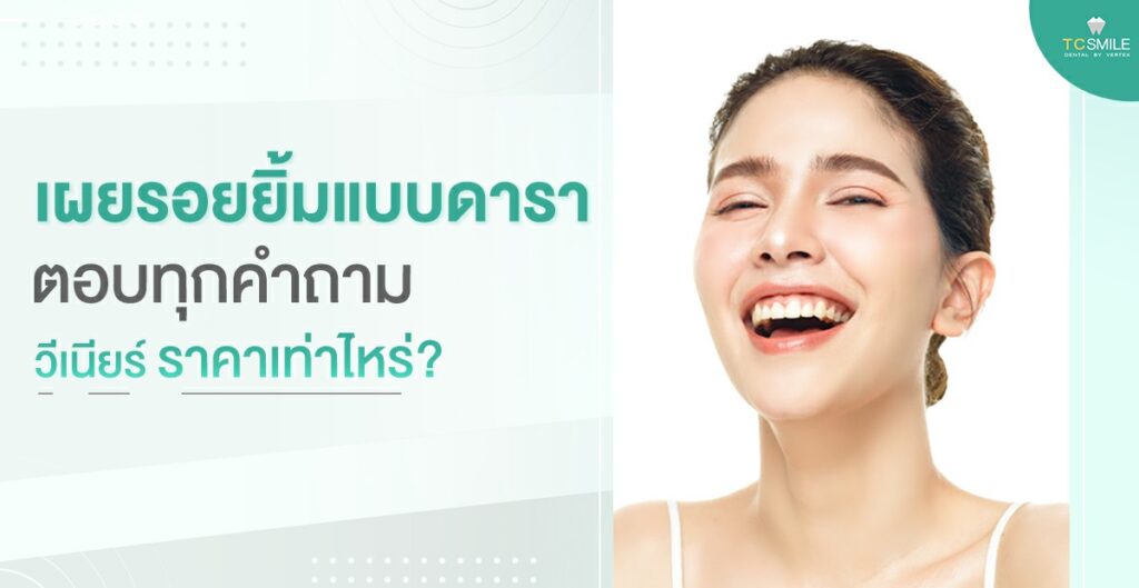 veneer-beautiful-teeth