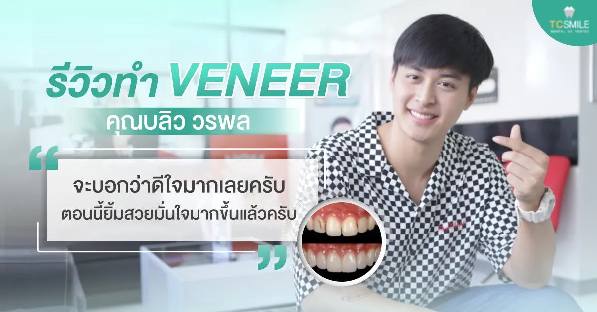 ทำวีเนียร์
