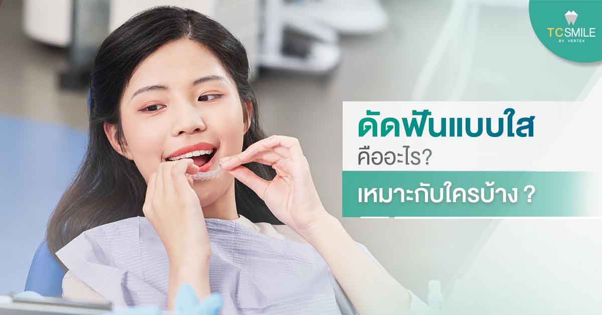 ดัดฟันแบบใสคืออะไร? เหมาะกับใครบ้าง?