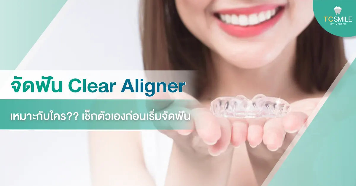 จัดฟัน Clear Aligner เหมาะกับใคร