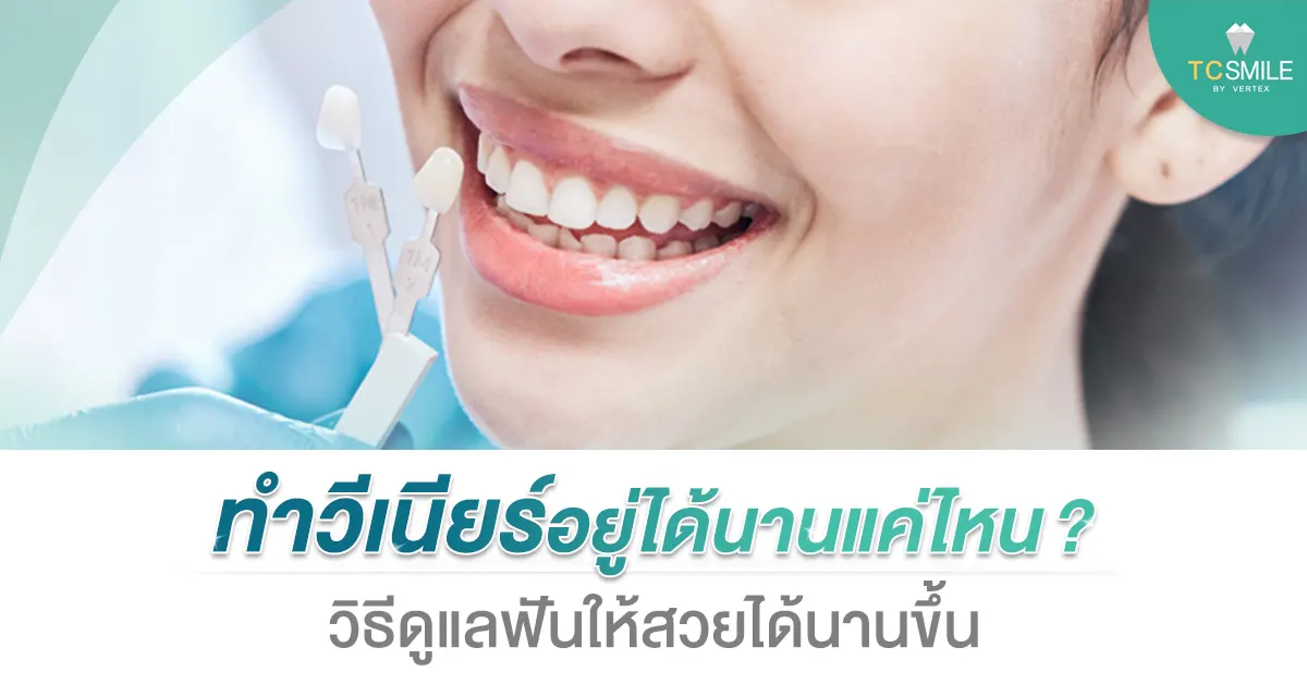 ทำวีเนียร์อยู่ได้นานแค่ไหน