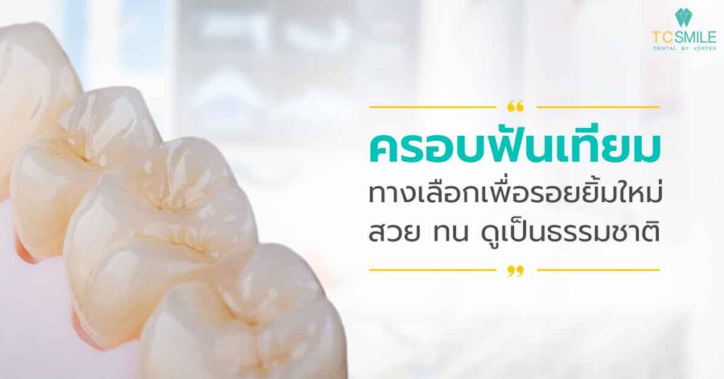 ครอบฟันเทียมทางเลือกเพื่อรอยยิ้มใหม่