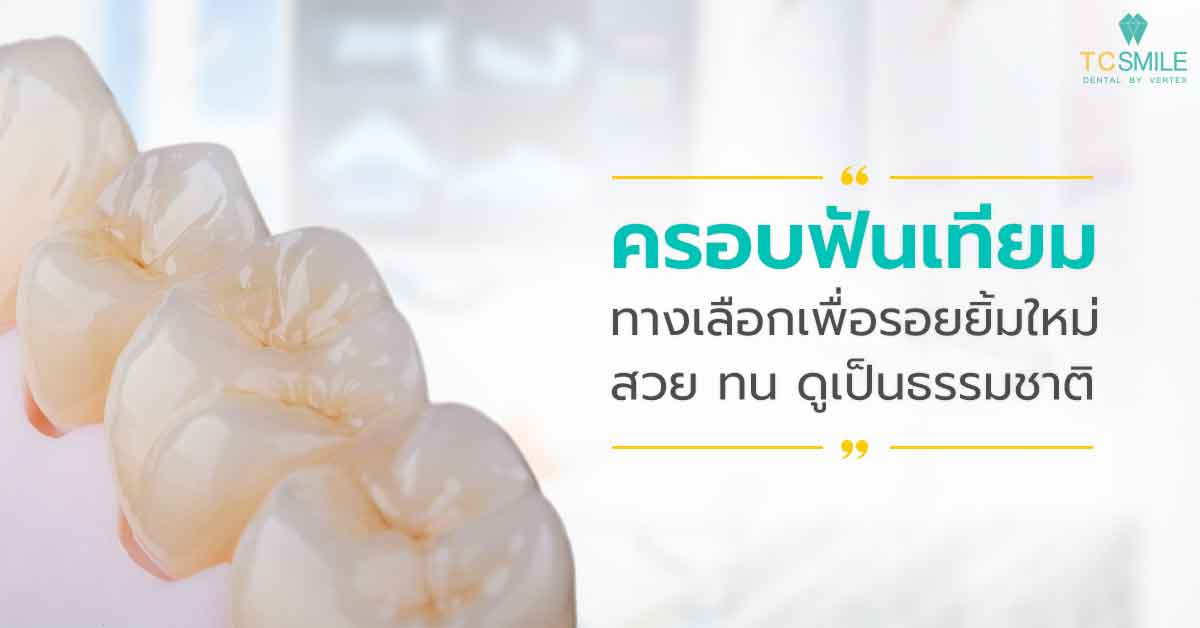 ครอบฟันเทียม ทางเลือกเพื่อรอยยิ้มใหม่ สวย ทน ดูเป็นธรรมชาติ 