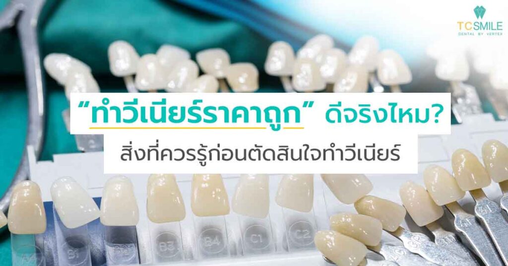 ทำวีเนียร์ราคาถูก ดีจริงไหม