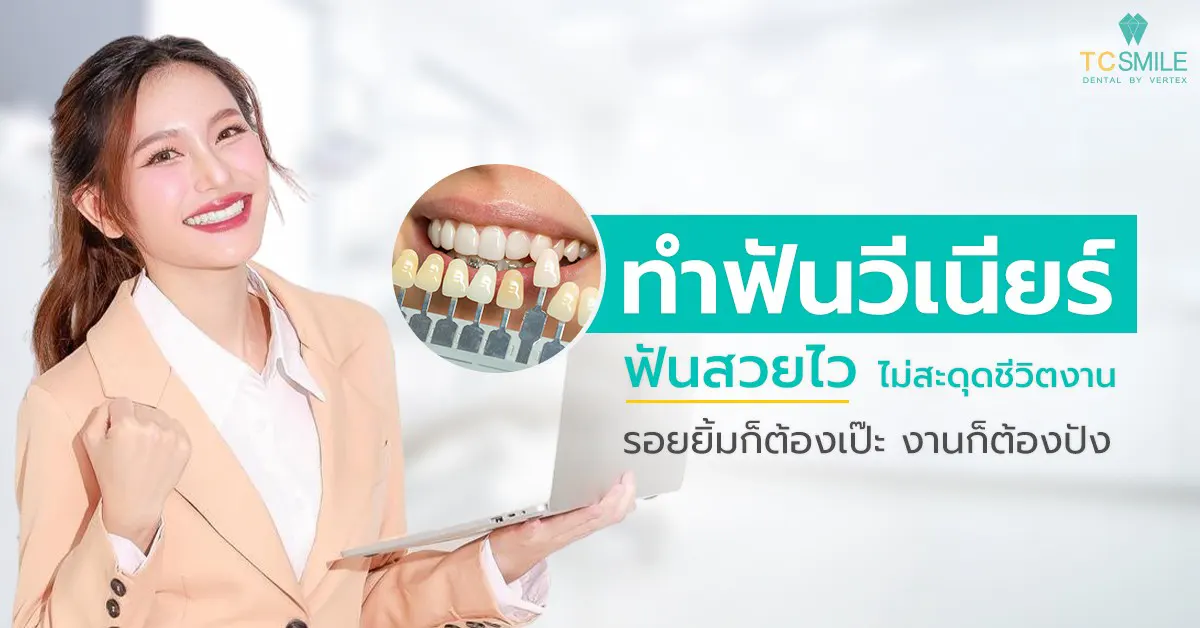 ทําฟันวีเนียร์ ฟันสวยไวไม่สะดุดชีวิตงาน