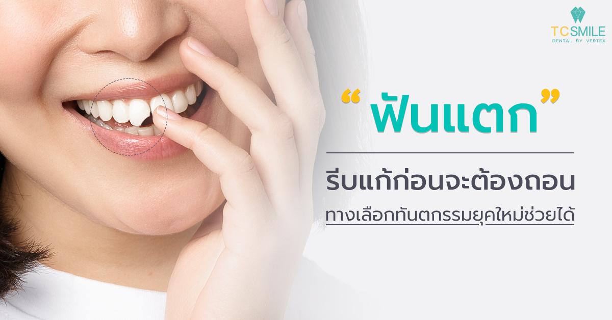 ฟันแตก รีบแก้ก่อนจะต้องถอน ทางเลือกทันตกรรมยุคใหม่ช่วยคุณได้