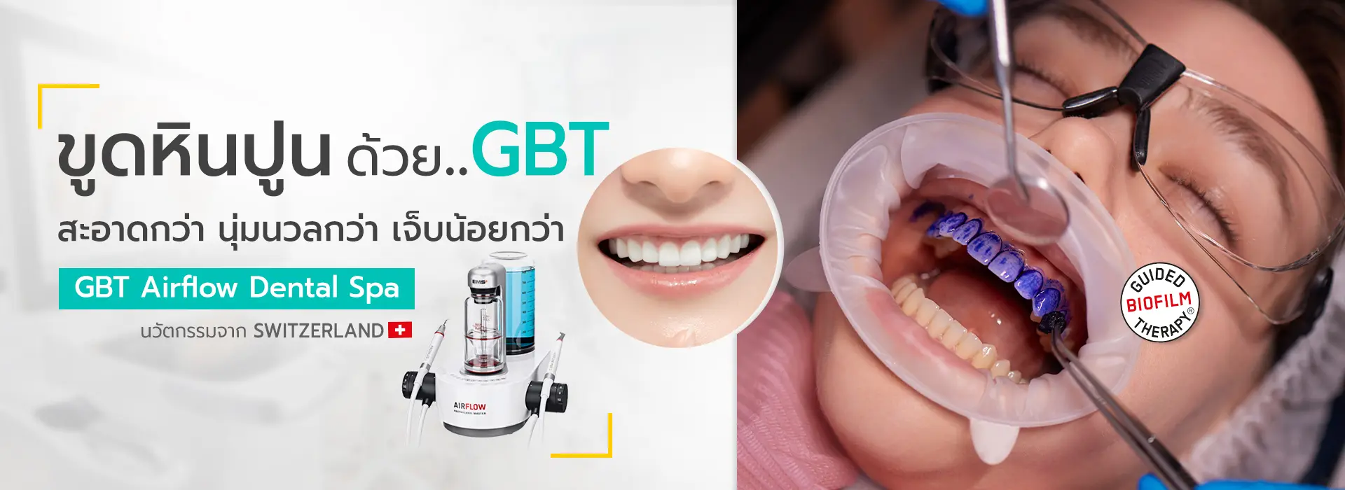 slide จัดฟันใส