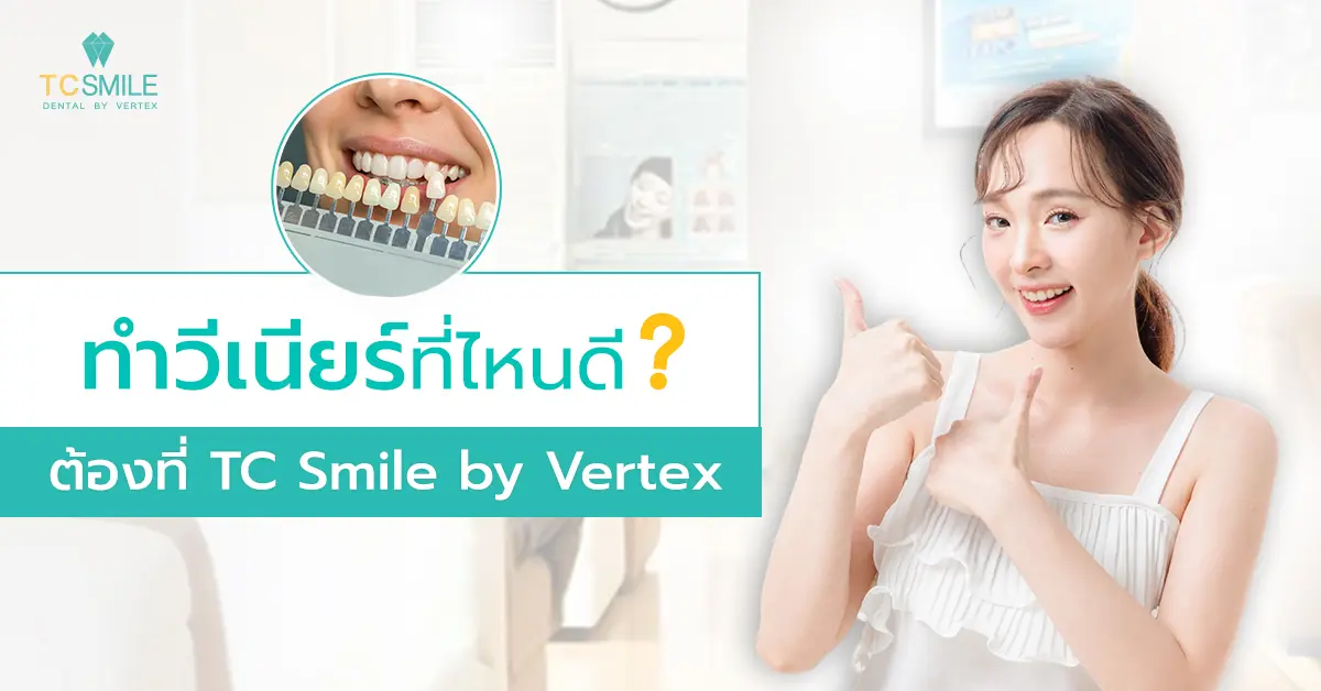 ทำวีเนียร์ที่ไหนดี