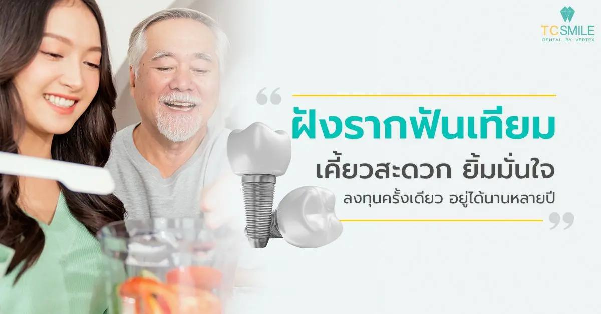 ฝังรากฟันเทียม