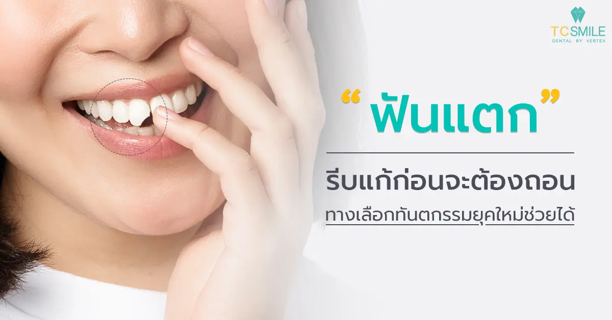 ฟันแตก รีบแก้ก่อนจะต้องถอน