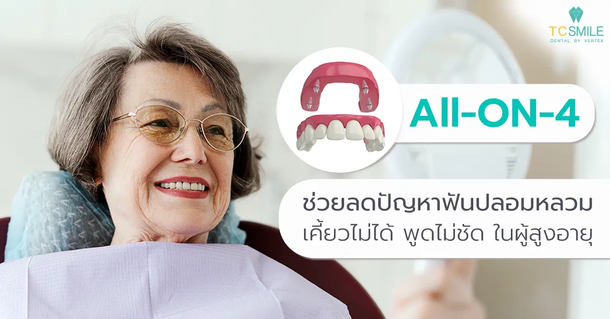 All-on-4 ช่วยลดปัญหาฟันปลอมหลวม