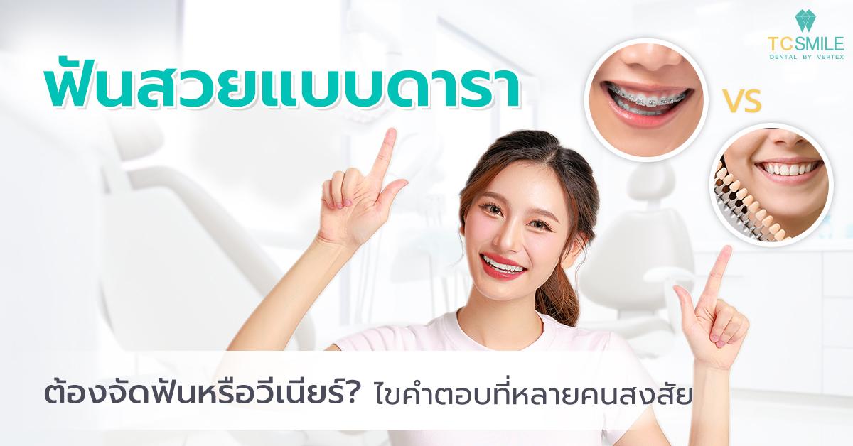 ฟันสวยแบบดารา ต้องจัดฟันหรือวีเนียร์? ไขคำตอบที่หลายคนสงสัย