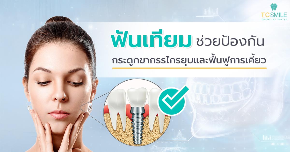 ฟันเทียมช่วยป้องกันกระดูกขากรรไกรยุบและฟื้นฟูการเคี้ยว