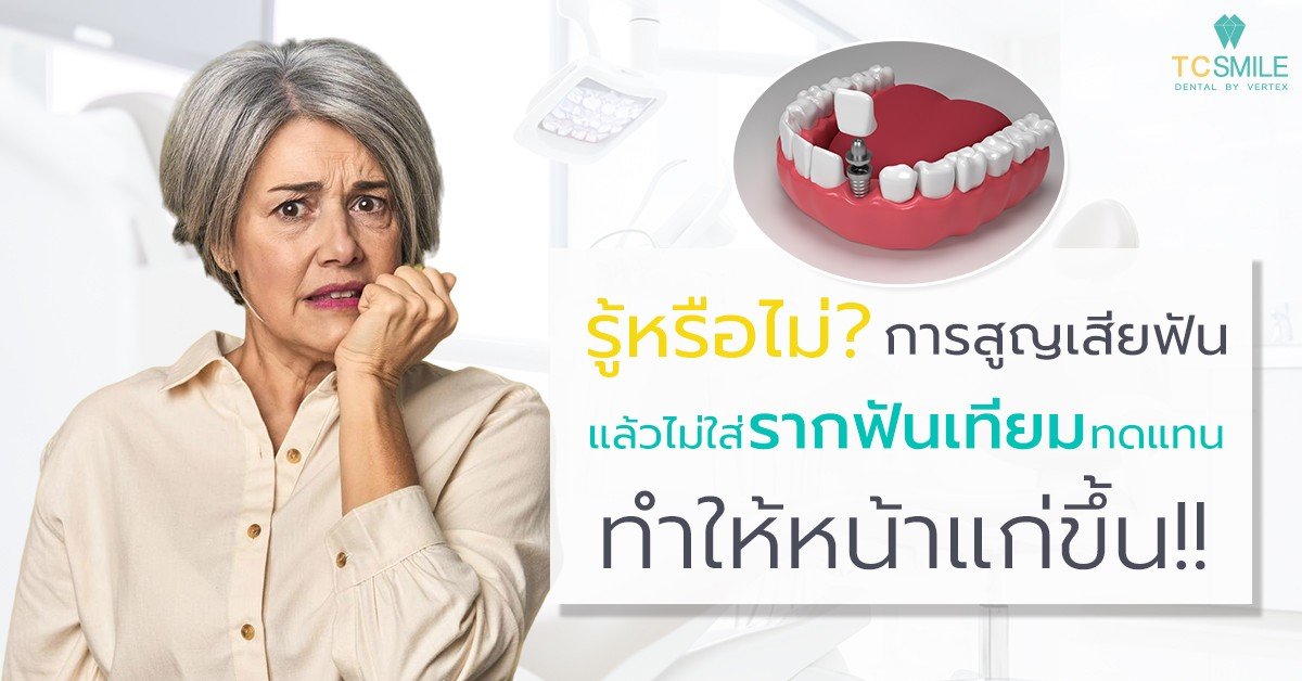 รากฟันเทียมสำคัญกว่าที่คิด เพราะฟันหายอาจทำให้หน้าแก่ลงโดยไม่รู้ตัว