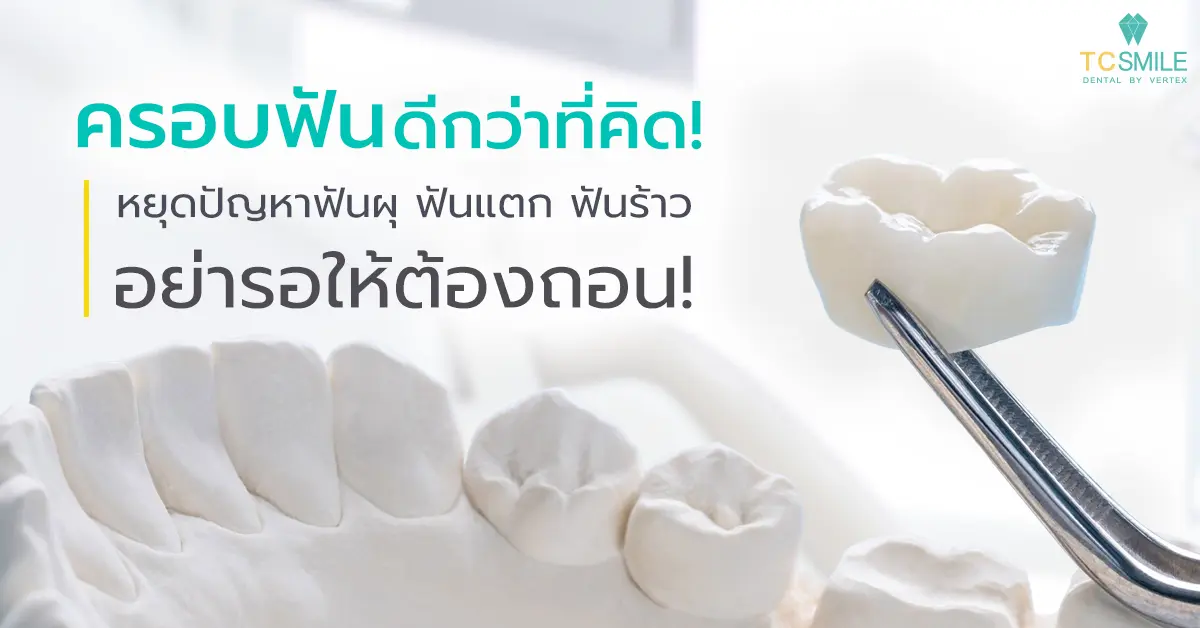 ครอบฟันดีกว่าที่คิด