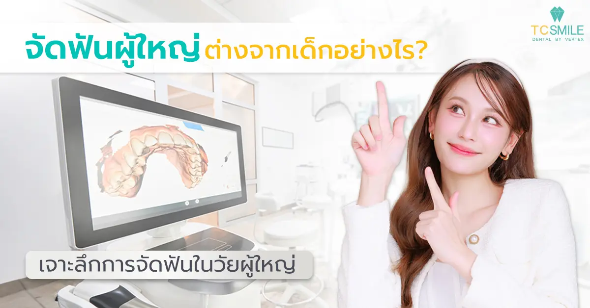 จัดฟันผู้ใหญ่ ต่างจากเด็กอย่างไร