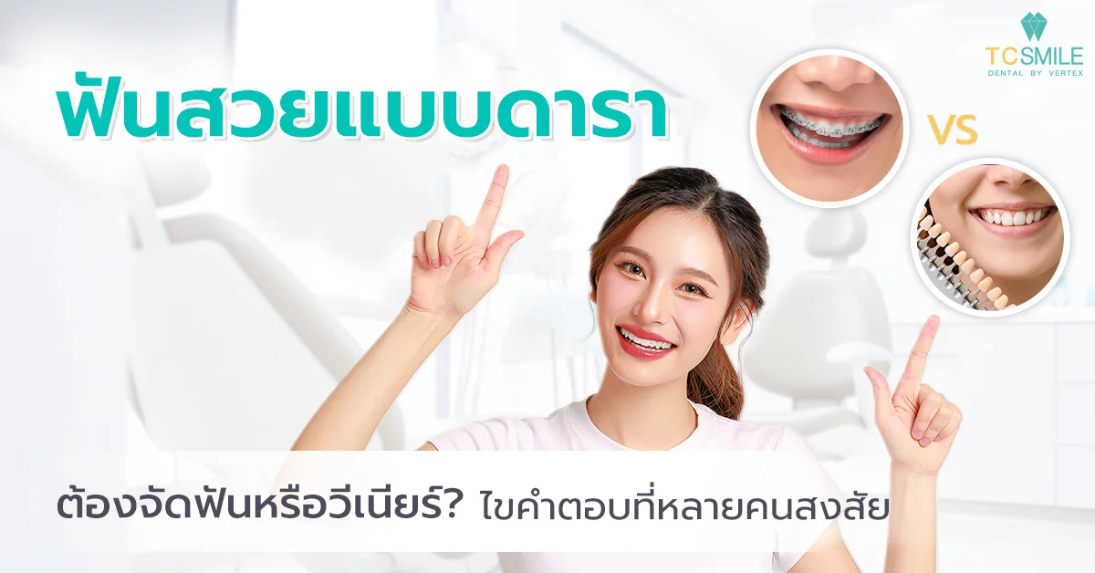 ฟันสวยแบบดารา