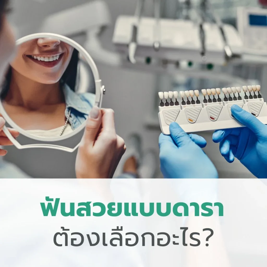 ฟันสวยแบบดาราต้องเลือกอะไร