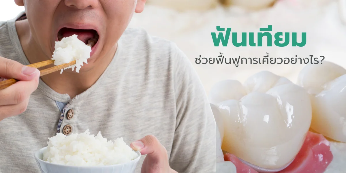 ฟันเทียมช่วยฟื้นฟูการเคี้ยวอย่างไร