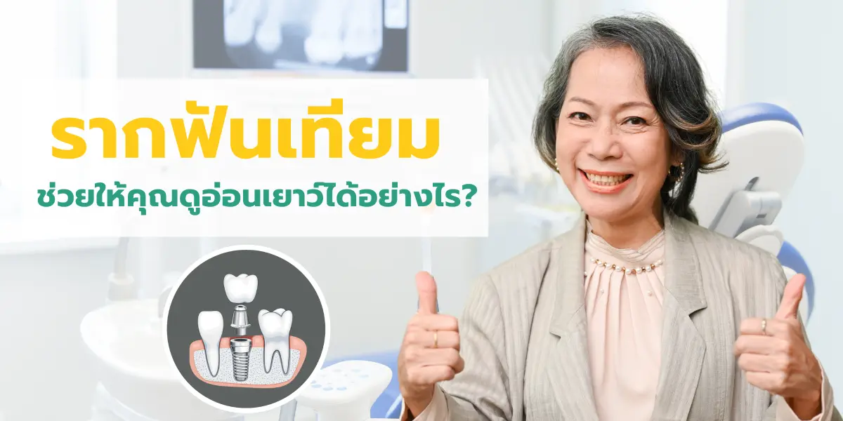 รากฟันเทียมช่วยให้คุณดูอ่อนเยาว์