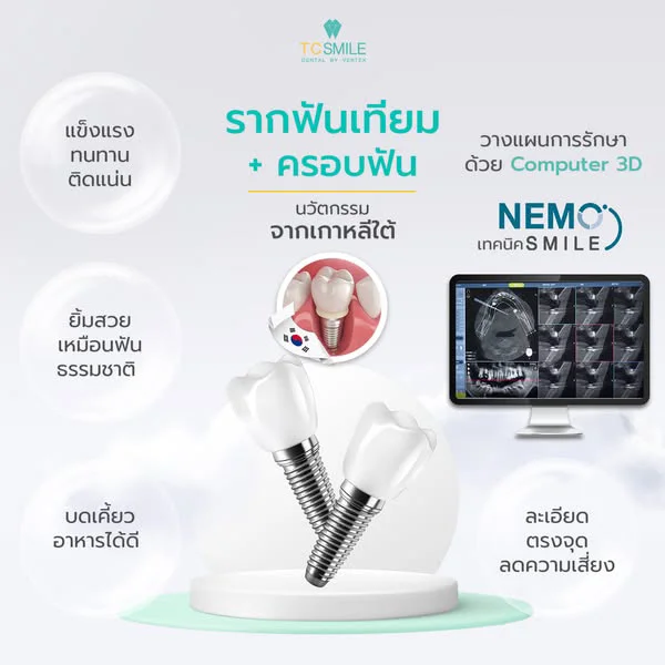รากฟันเทียมราคา