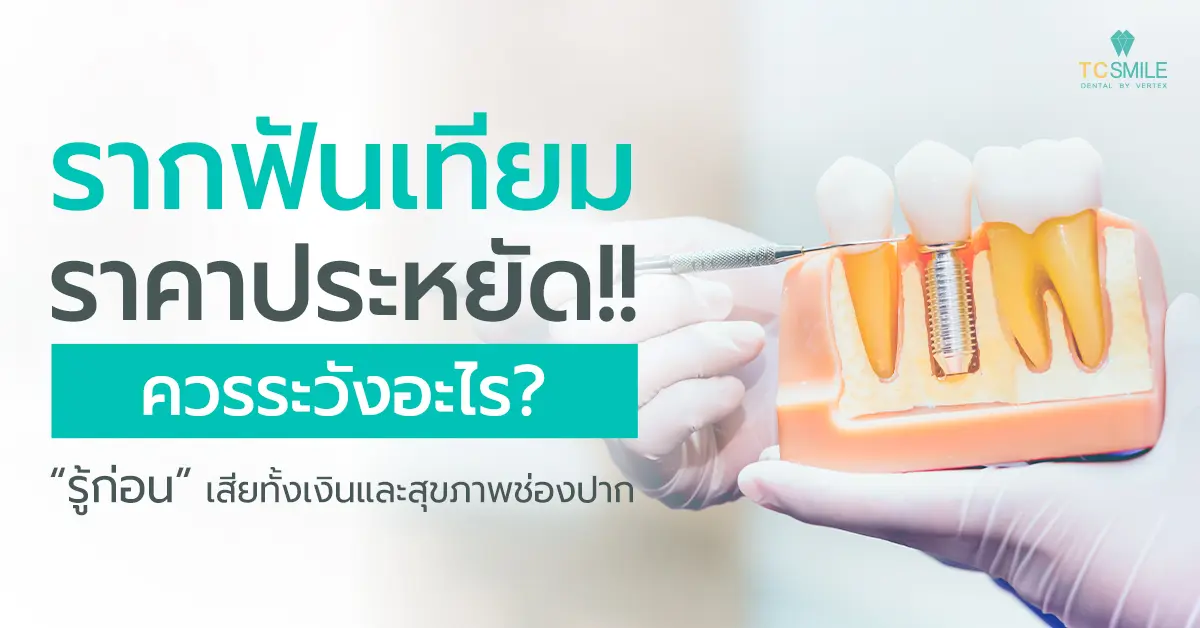 รากฟันเทียมราคาประหยัด
