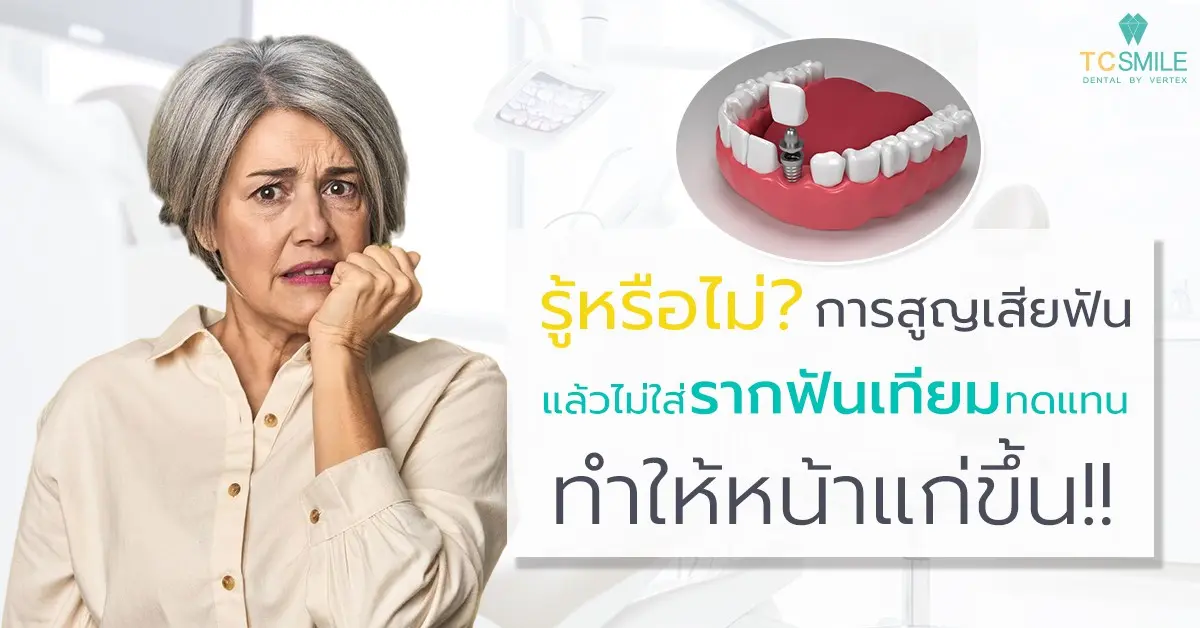 รากฟันเทียมสำคัญกว่าที่คิด