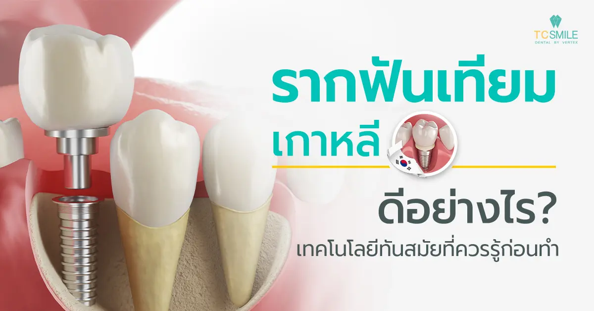 รากฟันเทียมเกาหลี ดีอย่างไร