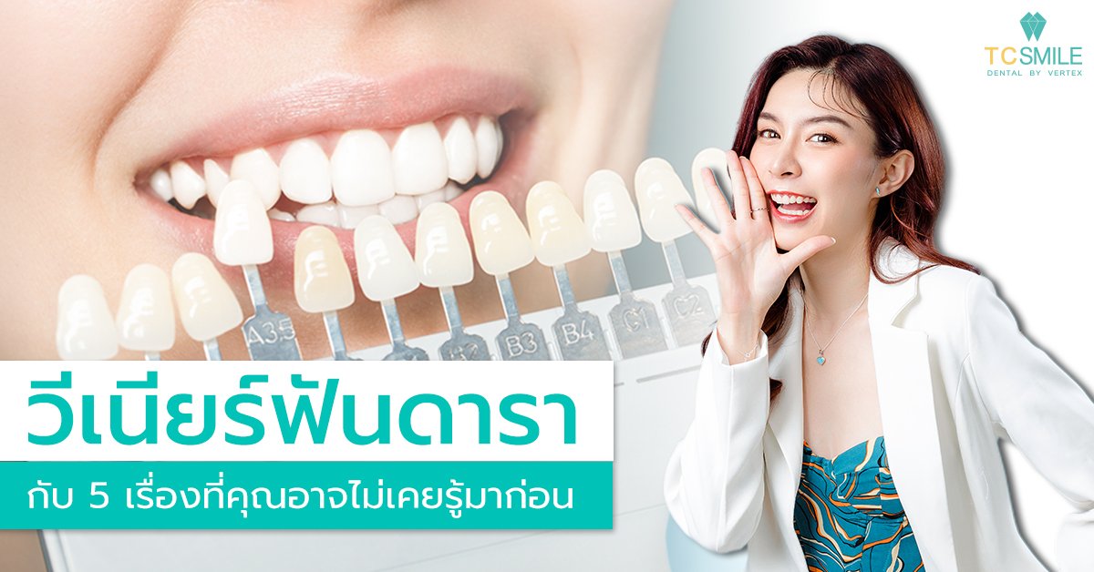 วีเนียร์ฟันดารา กับ 5 เรื่องที่คุณอาจไม่เคยรู้มาก่อน