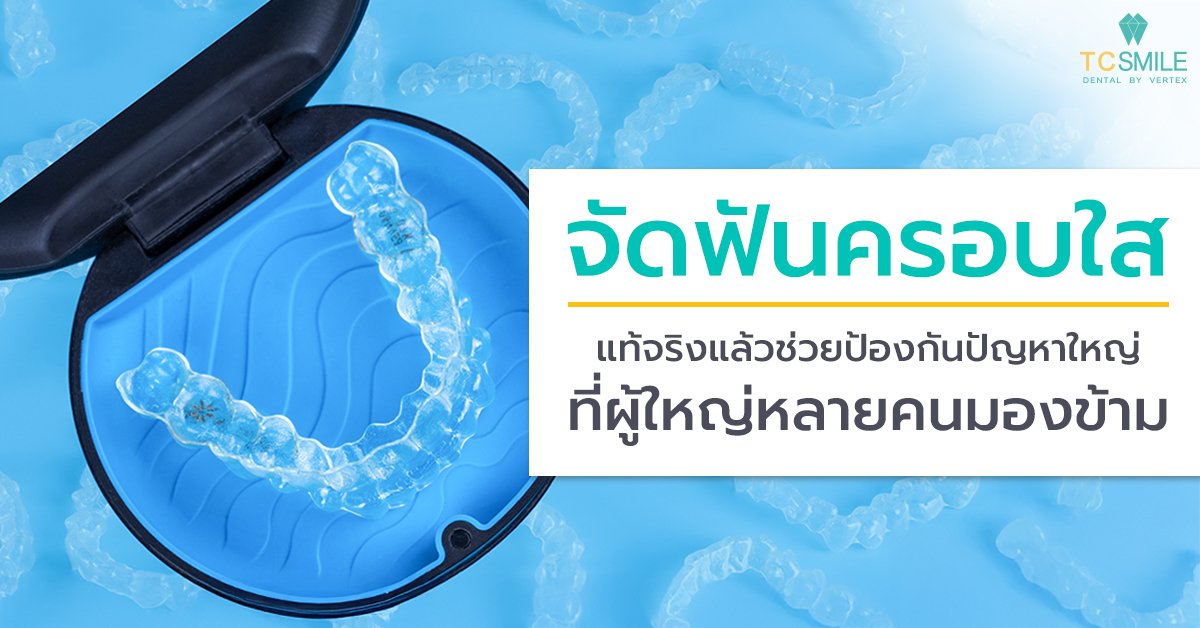 จัดฟันครอบใส แท้จริงแล้วช่วยป้องกันปัญหาใหญ่ที่ผู้ใหญ่หลายคนมองข้าม