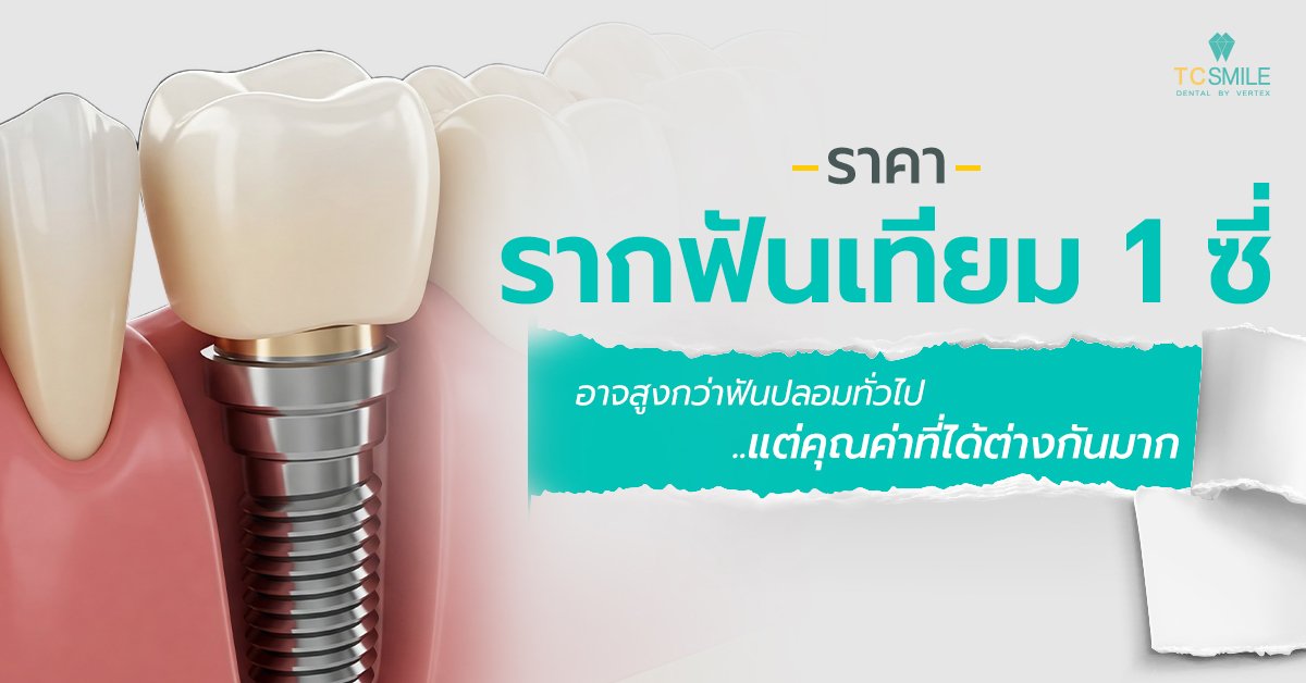 ราคารากฟันเทียม 1 ซี่ อาจสูงกว่าฟันปลอมทั่วไป แต่คุณค่าที่ได้ต่างกันมาก