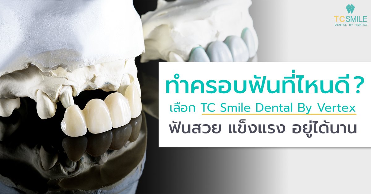 ทำครอบฟันที่ไหนดี เลือก TC Smile Dental By Vertex ฟันสวย แข็งแรง อยู่ได้นาน