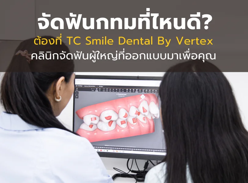 จัดฟันกทมที่ไหนดีต้องที่ TC Smile Dental By Vertex คลินิกจัดฟันผู้ใหญ่ที่ออกแบบมาเพื่อคุณ