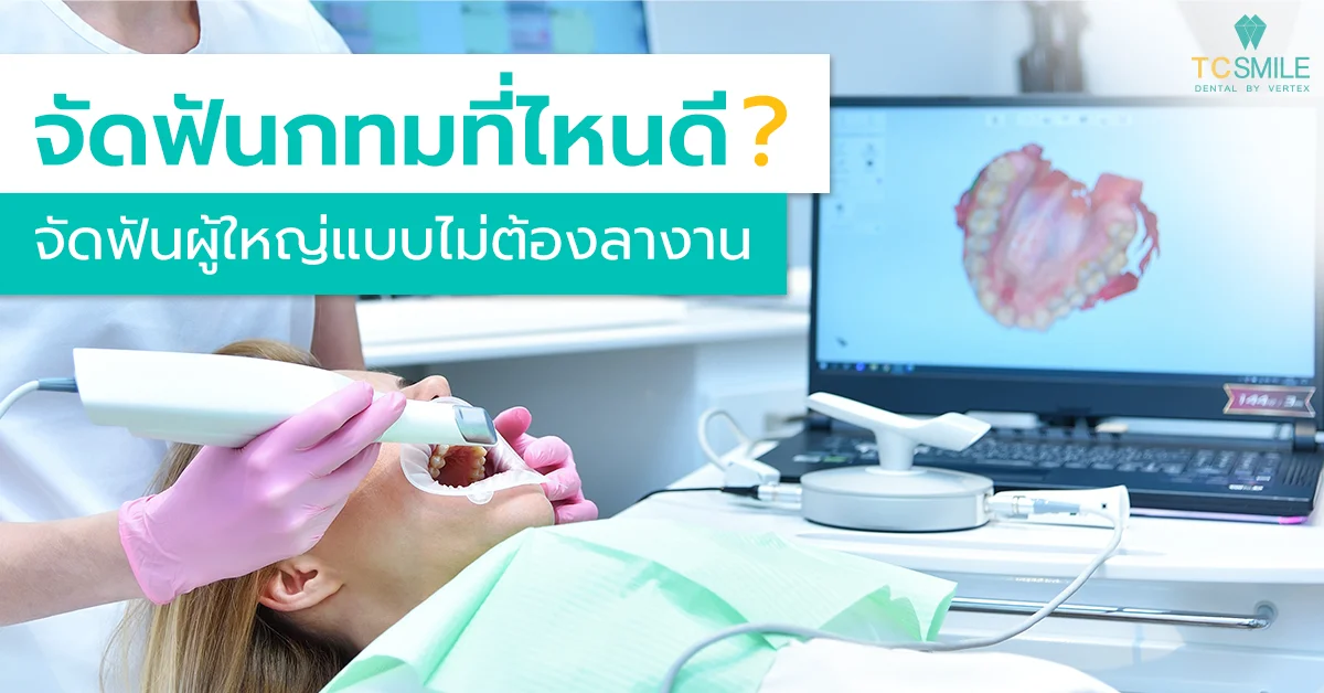 จัดฟันกทมที่ไหนดี จัดฟันผู้ใหญ่แบบไม่ต้องลางาน