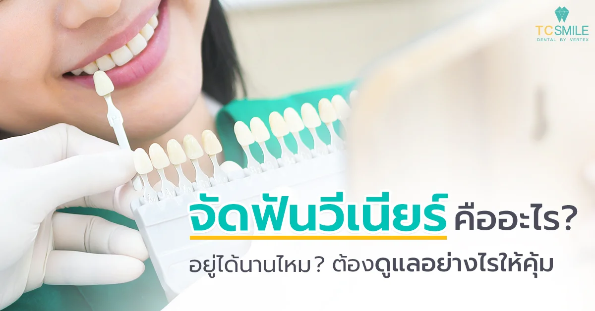 จัดฟันวีเนียร์ คืออะไร