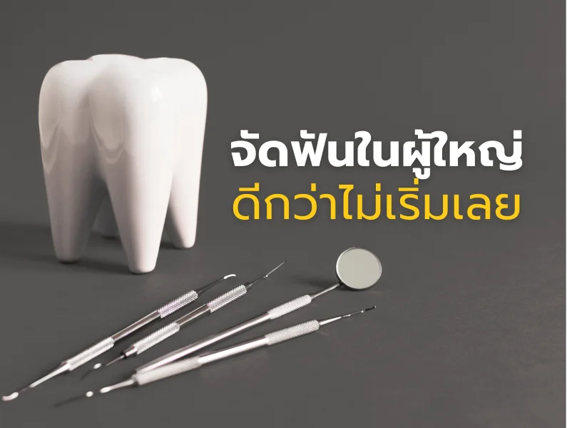 จัดฟันในผู้ใหญ่ ดีกว่าไม่เริ่มเลย